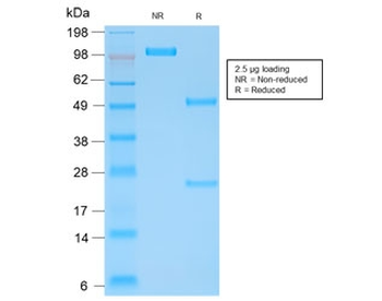 Recombinant Kappa Light Chain Antibody