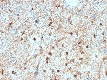 Glial Fibrillary Acidic Protein Antibody / GFAP