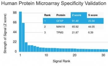 Glial Fibrillary Acidic Protein Antibody / GFAP