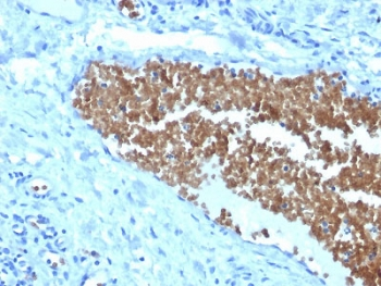 Spectrin alpha 1 Antibody / SPTA1