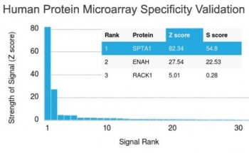 Spectrin alpha 1 Antibody / SPTA1