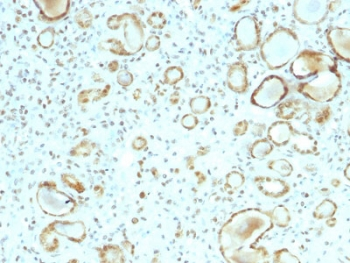 STAT6 Antibody