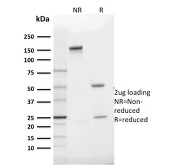 GLUT1 Antibody