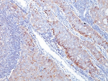 GLUT1 Antibody
