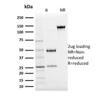 Ubiquitin Antibody