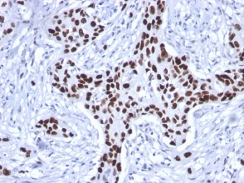 Recombinant p53 Antibody / TP53