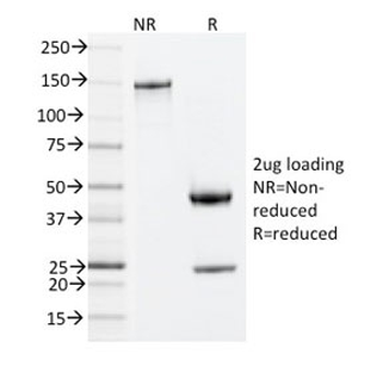 ZAP70 Antibody
