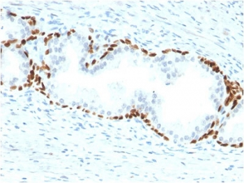 p63 Antibody / Tumor protein 63