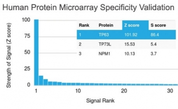 p63 Antibody / Tumor protein 63