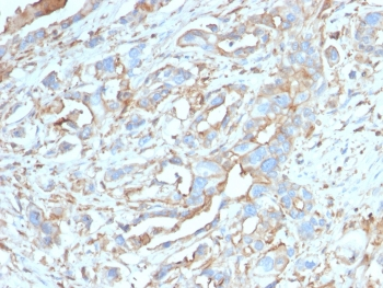 PD-L1 Antibody / B7-H1 / CD274
