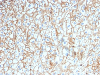 PD-L1 Antibody / B7-H1 / CD274