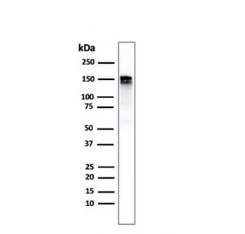 EGF Receptor / EGFR Antibody
