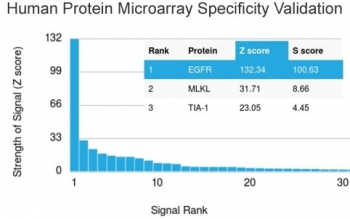 EGF Receptor / EGFR Antibody