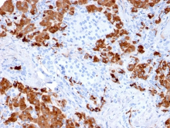 Carboxypeptidase A1 Antibody / CPA1