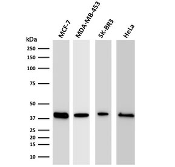 RPSA Antibody / 40S Ribosomal protein SA / Laminin Receptor 1