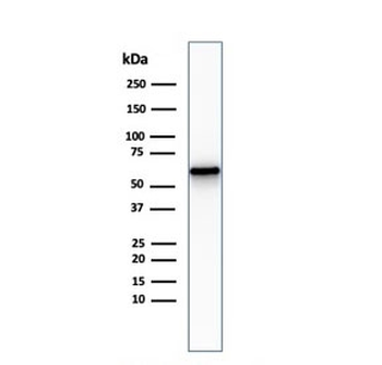 Recombinant NGFR Antibody / p75NTR