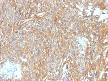 Recombinant DOG1 Antibody