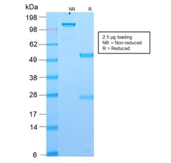 Recombinant DOG1 Antibody