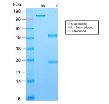 Recombinant Bcl6 Antibody