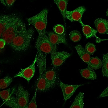 S100A2 Antibody