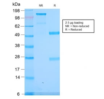 Recombinant Spectrin alpha 1 Antibody / SPTA1