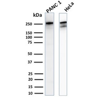 Recombinant Spectrin beta III Antibody / SPTBN2