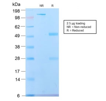 Recombinant Spectrin beta III Antibody / SPTBN2