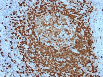 TCL1 Antibody