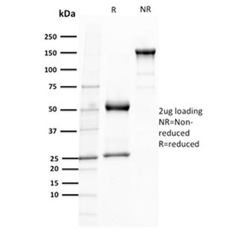 TCL1 Antibody