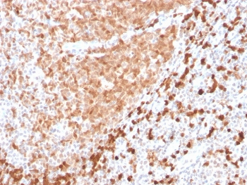 Recombinant TCL1 Antibody