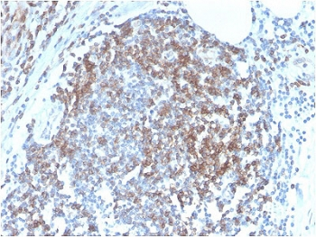 Recombinant CD6 Antibody