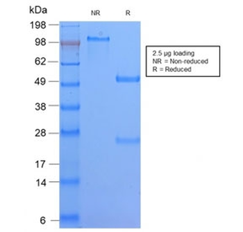 Recombinant HLA-DQ Antibody (MHC II)