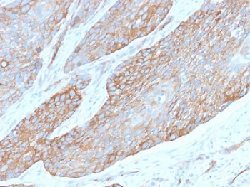 Recombinant Spectrin beta III Antibody / SPTBN2