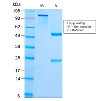 Recombinant Spectrin beta III Antibody / SPTBN2