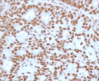 Recombinant TLE1 Antibody / Transducin-like enhancer protein 1