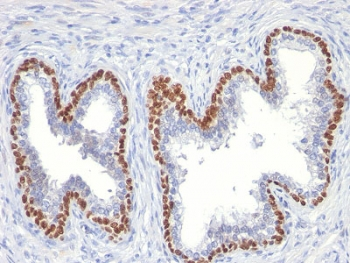 p63 Antibody / Tumor protein 63