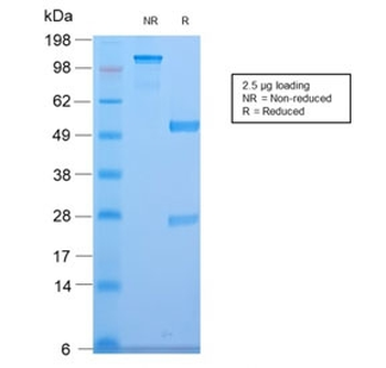 Recombinant CELA3B Antibody / Elastase 3B