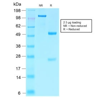 Recombinant Villin Antibody / VIL1