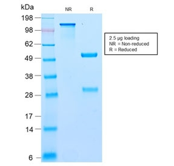 Recombinant Bcl10 Antibody