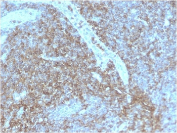 Recombinant CD44 Antibody