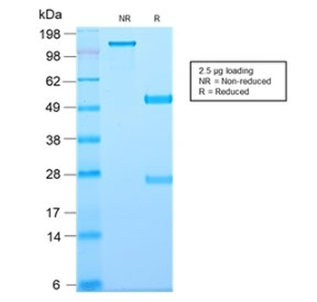 Recombinant CD81 Antibody