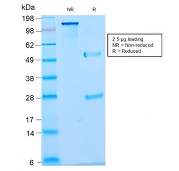 Recombinant Nuclear Marker Antibody