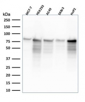 Recombinant MCM7 Antibody