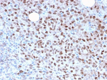 Recombinant MITF Antibody