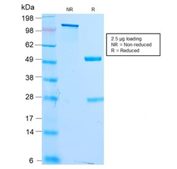 Recombinant MITF Antibody