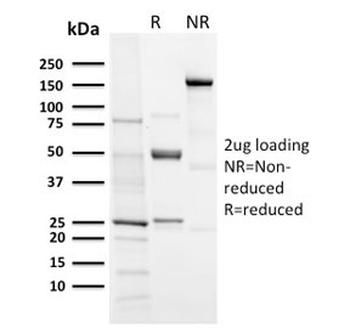 Recombinant Aurora B Antibody / AURKB