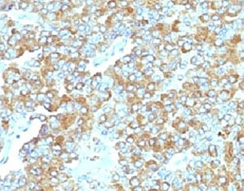TIM3 Antibody / HAVCR2