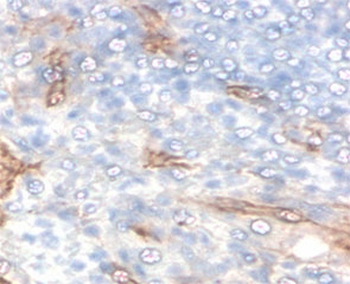 TIM3 Antibody / HAVCR2