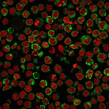 Pan-HLA Antibody (DP/DQ/DR)