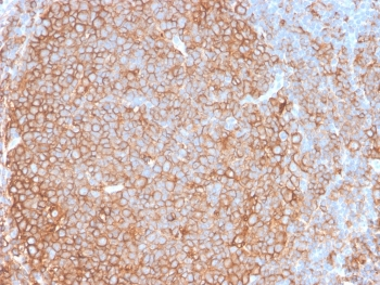 Pan-HLA Antibody (DP/DQ/DR)